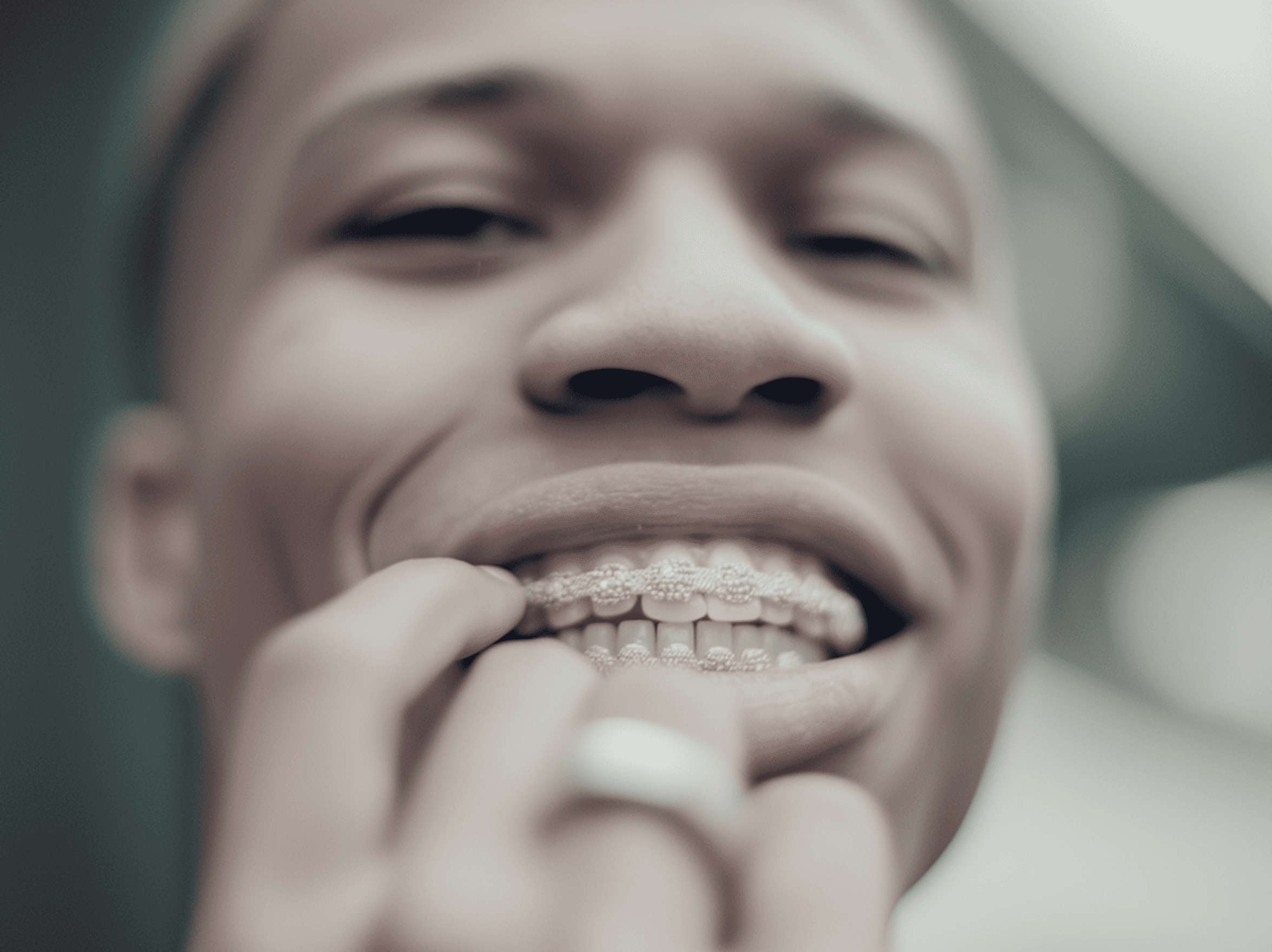Close-up of smiling person wearing decorative dental grills and ring, with blurred background.