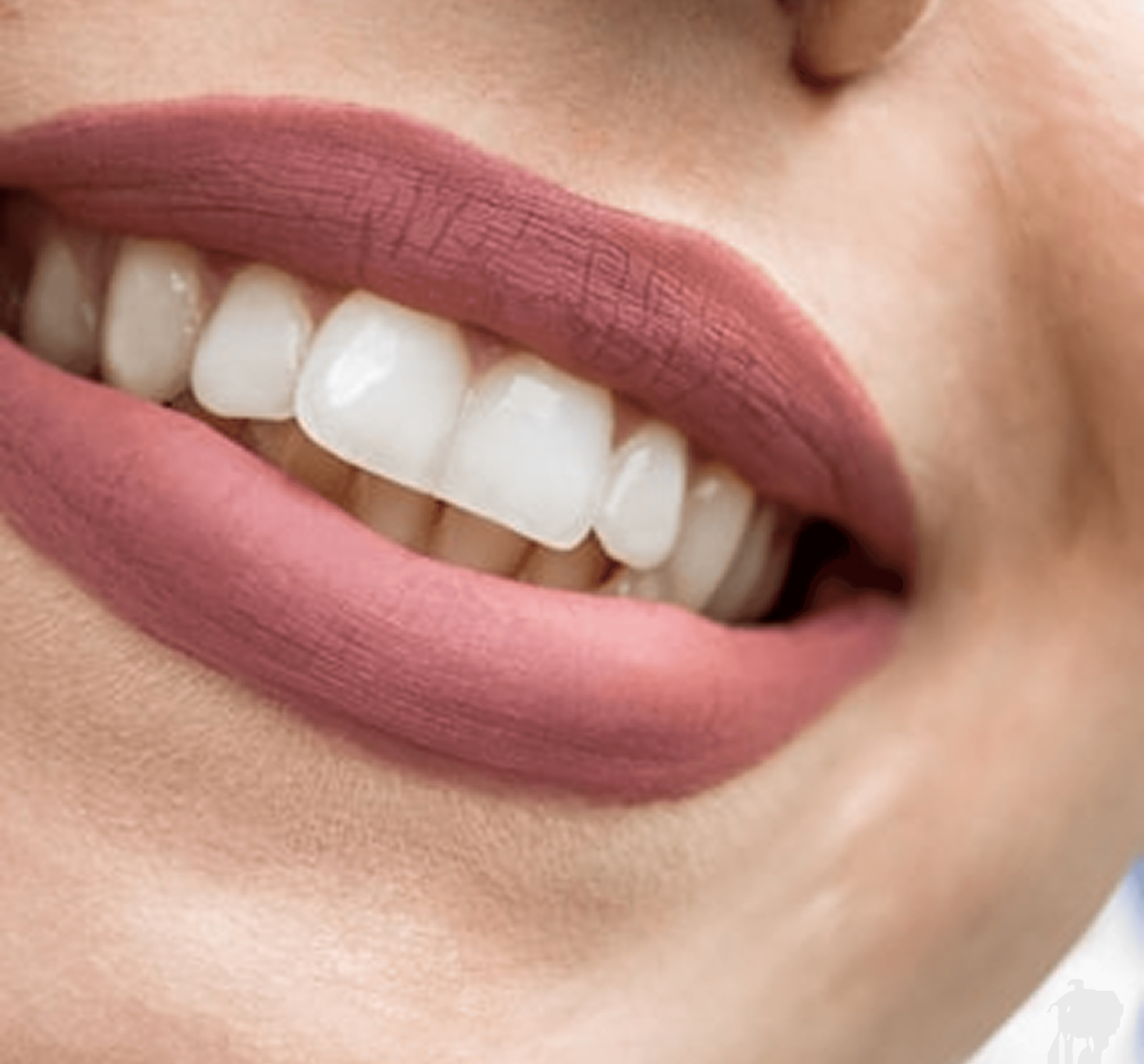 Close-up of mouth with matte mauve lipstick and clean, well-aligned teeth